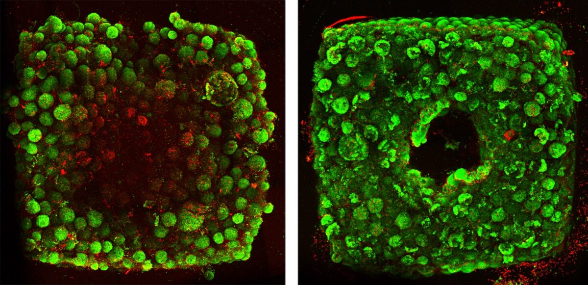 A new approach to 3d printing human organs